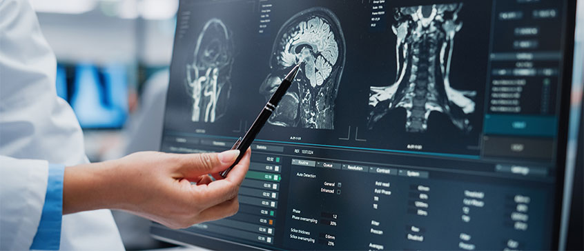 Photo of doctor pointing to brain scan report. 